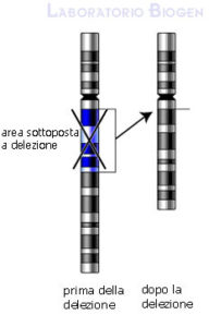 Delezioni cromosomiche
