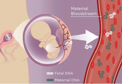 Il Test Prenatale- Test di ultima generazione non invasivo su sangue materno