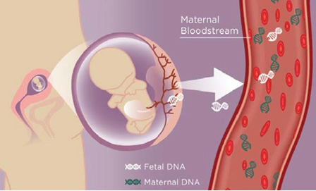Il Test Prenatale- Test di ultima generazione non invasivo su sangue materno