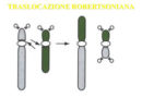Infertilità e traslocazioni robertsoniane